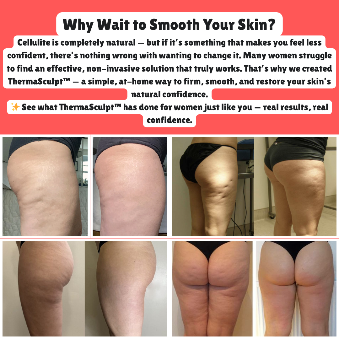 ThermaSculpt™ - Smoother Healthier Skin Starts Here