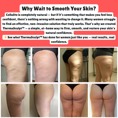 ThermaSculpt™ - Smoother Healthier Skin Starts Here